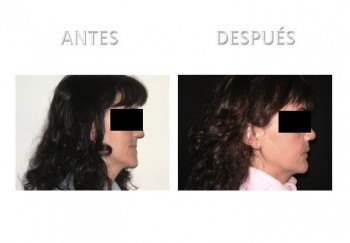 1- Diapositiva 3