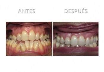 1- Diapositiva 4