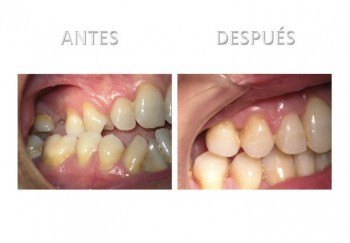 1- Diapositiva 5