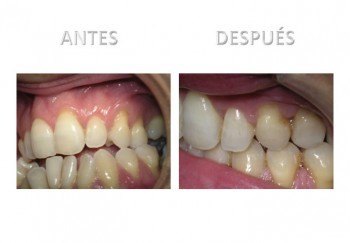 1- Diapositiva 6