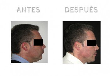 2- Diapositiva 2