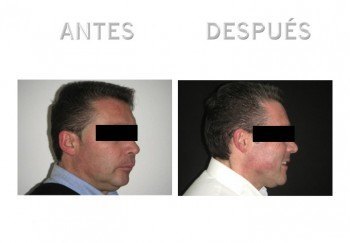 2- Diapositiva 3