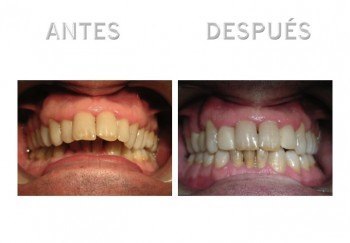 2- Diapositiva 4