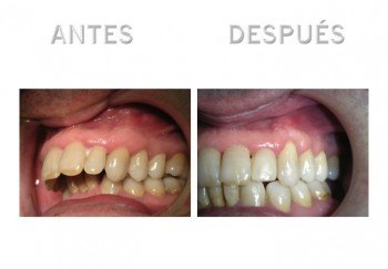 2- Diapositiva 5