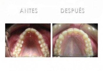 3- Diapositiva 6