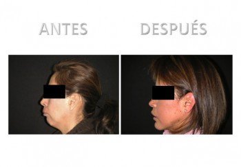 4- Diapositiva 2